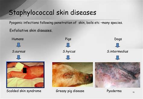 Ppt Staphylococcus And Streptococcus Powerpoint Presentation Id795814