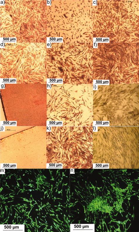 Examples For Adherent Human Dermal Fibroblasts On Tcps Controls