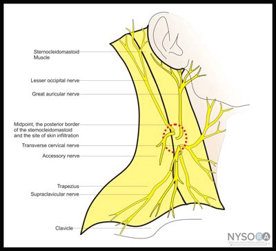 Cervical Plexus Block - NYSORA The New York School of Regional Anesthesia