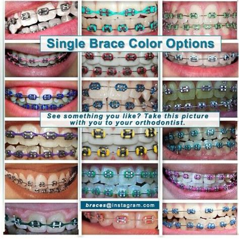 Dental Braces Colors Pink Braces Green Braces Cute Braces Colors