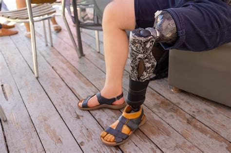 Premium Photo New Aluminium Prostheses Legs For Amputee Patient