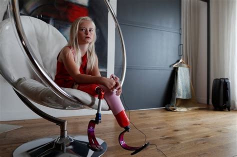 10 Year Old Double Amputee Who Lost Her Legs As A Baby Is Now A Catwalk