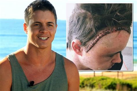 The news comes after johnny underwent emergency surgery to remove a brain tumour earlier this month. Home And Away star Johnny Ruffo shares harrowing picture ...