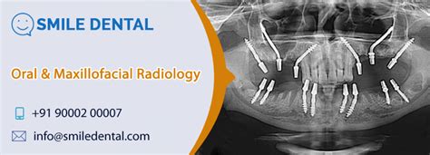 Oral And Maxillofacial Radiologists In Dilsukhnagar Smile Dental