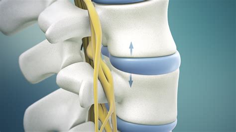 Microdiscectomy Spine Surgerys Purpose Of Procedure And Success Rate