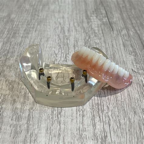 Little Rock Dentures And Implants Updated April 2024 3006 E Kiehl