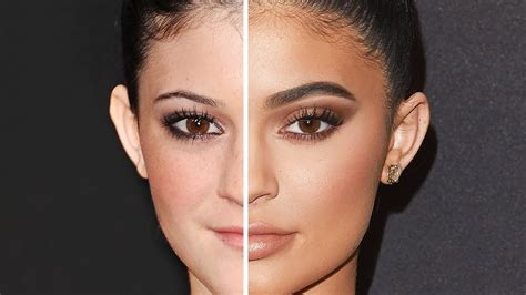 Kylie Jenner Before Pin By Sarah Bradley On Plastic Surgery Kylie