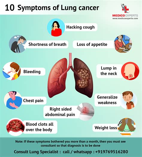 10 Symptoms Of Lung Cancer Medicoexperts