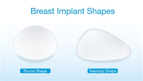 Breast Implant Types Northern Virginia Washington Dc The Naderi Center