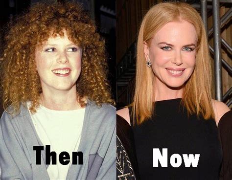 The Beauty Of Nicole Kidman Then And Now