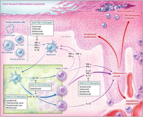 Pathophysiology Clinical Presentation And Treatment Of Psoriasis A