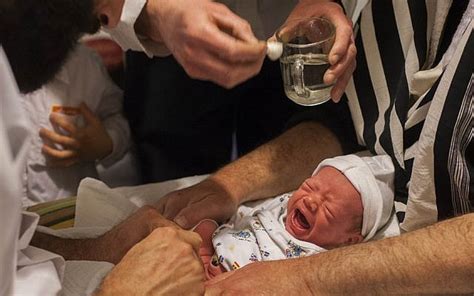 The Pros And Cons Of Neonatal Circumcision Chicagojewishnews Com
