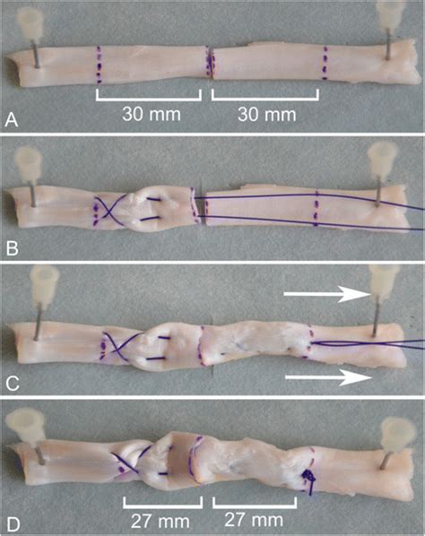 Additional Steps For Suture Pretensioning A Tendon Purchase Of 30 Mm Download Scientific