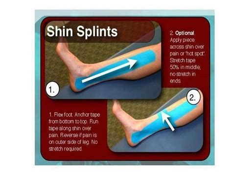Shin Splint Excercise Shinpainduringexercise Shin Splints Shin