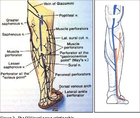 Figure 1 From Treating The Small Saphenous Vein Anatomical