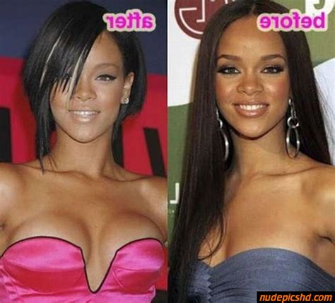 Rihanna Plastic Surgery Before After Nude Leaked Porn Photo