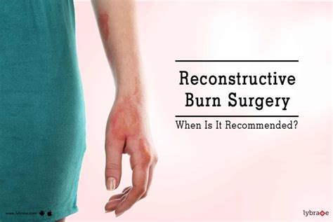 Reconstructive Burn Surgery When Is It Recommended By Dr Purnima Aiyer Lybrate