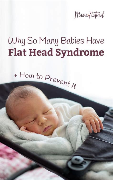 Plagiocephaly Aka Flat Head Syndrome What You Need To Know Flat Head