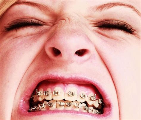 Ask your orthodontist to cut your wires short and reduce their size so that they do not dig into your skin. How to Make Your Braces Stop Hurting - Healthrow.net