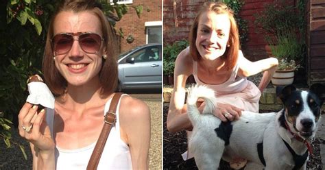 Woman With Anorexia Claims Nhs Turned Her Down For Treatment Because