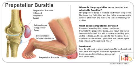 Knee Bursitis Treatment