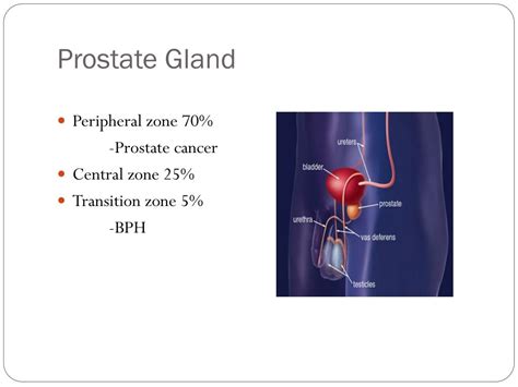 Ppt Neoplasms Of The Prostate Gland Powerpoint Presentation Free Download Id