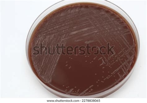 Neisseria Meningitidis Growing On Chocolate Agar Stock Photo 2278838065