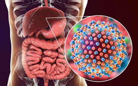 Early Treatment For HCV Infection Provides Benefits Beyond Liver Disease Gastroenterology Advisor