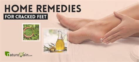 6 Diy Home Remedies For Cracked Feet And Sore Heels That Work