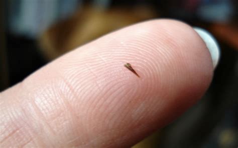 So, you need to get rid of cactus bugs on your succulents. How to Get Rid of a Splinter Safely? Try These 10 Home ...