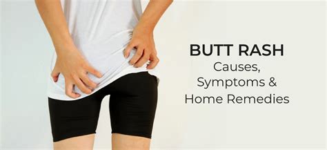 Butt Rash Possible Causes Symptoms And Remedies Daily Health Cures