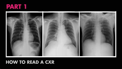 Labeled scrollable chest ct teaching radiologic anatomy with a level of detail appropriate for medical students. Anatomy of a Chest X-Ray - How to Read a Chest X-Ray (Part ...