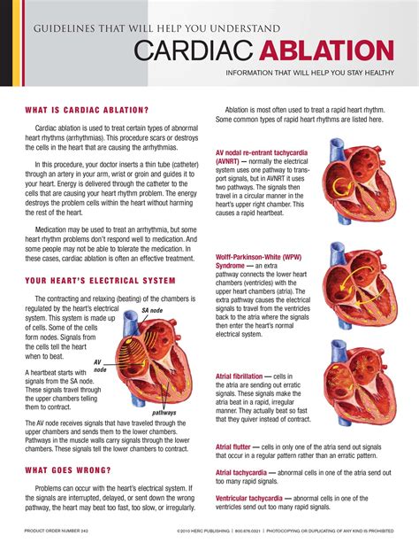 Cardiac Ablation Herc Publishing