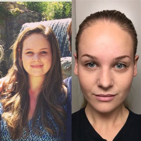 Sophiehuntington Submitted 50lb Loss Face Before And After Weight