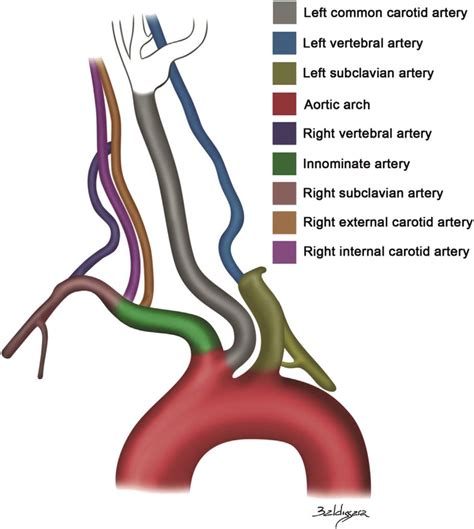 In human heart diagram the coronary arteries are the first to accept the blood that is reach is oxygen. Absence of right common carotid artery and common origin of the... | Download Scientific Diagram