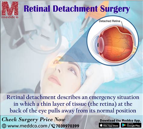 Retinal Detachment Surgery An Overview