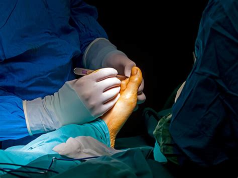 Kann Foot Surgery Consultant Podiatric Surgeon Essex