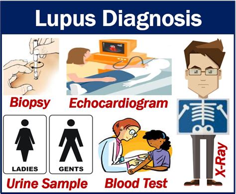 Lupus Diagnosis And Different Types Of Tests Doctors Order Mbn Health