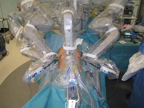Robot Surgical Operation For Prostatectomy