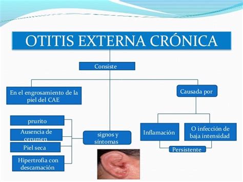 Otitis Externa Otl Ucc Santa Marta Medicina