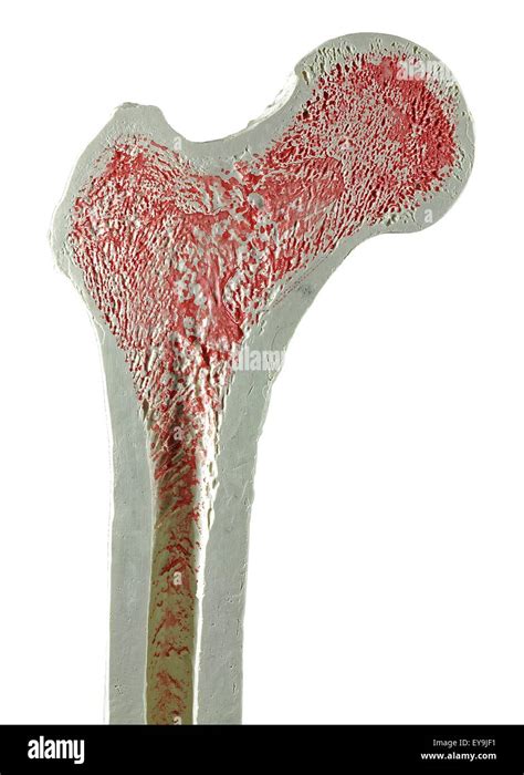 Human Femur Spongy Bone Cut Out Stock Images Pictures Alamy