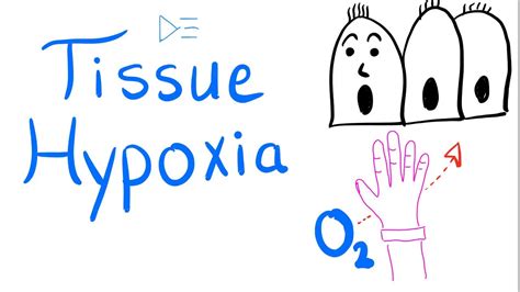 Tissue Hypoxia Respiratory Physiology Pulmonary Medicine Youtube