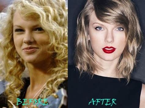 Taylor Swift Before And After Plastic Surgery 01 Celebrity Plastic