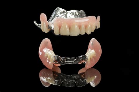 Metal Dentures What Are They And What Do You Need To Know About Them Harcourt Health