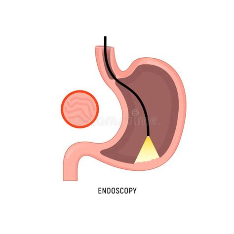 Endoscopy Stomach Anatomy Equipment Vector Illustration Esophagus