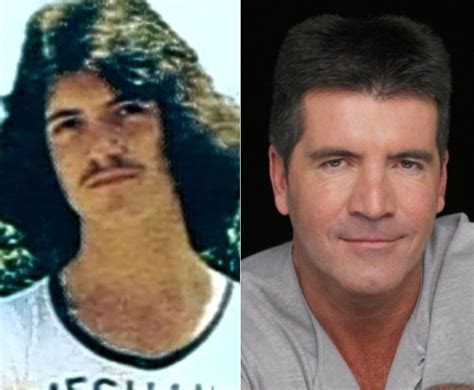 Simon Cowell And Plastic Surgery