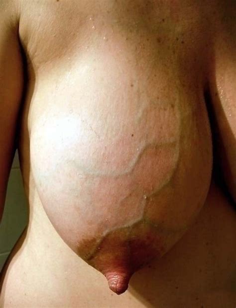Big And Huge Natural Tits Nipples Saggy Chubby Puffy Pics