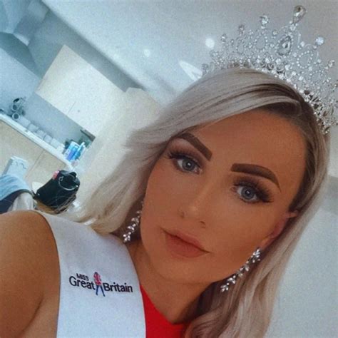 Missnews Miss Lincolnshire Hoping To Become First Miss Great Britain Winner With Alopecia