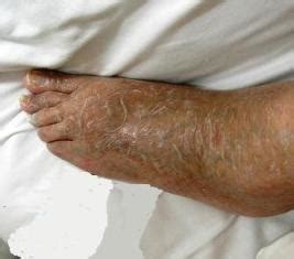 blog_10 ～鶴巻温泉病院で自慢できること 2～ 栄養科の取り組み ...