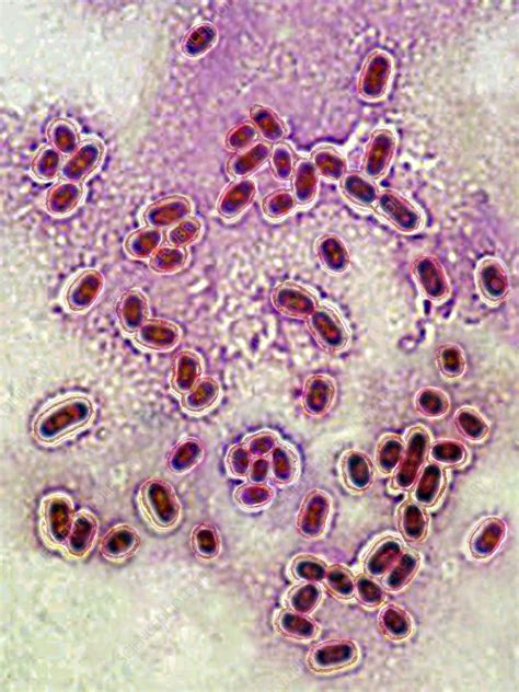 Streptococcus Pneumoniae Stock Image C0214487 Science Photo Library